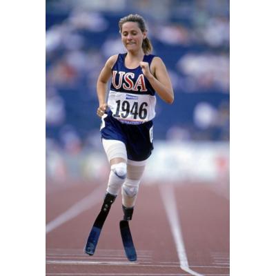 Американская актриса, модель и участница Паралимпийских игр 1996 года Эйми Маллинз, несмотря на инвалидность, сумела преуспеть в различных сферах жизни и найти личное счастье