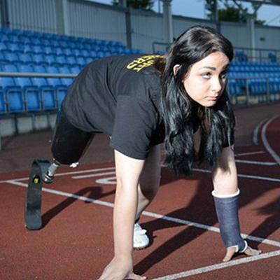 Несколько лет назад британская бегунья Даниэль Брэдшоу, заявила, что хочет ампутировать вторую ногу ради участия в Паралимпийских играх
